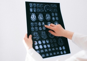 C.RE.CER.  recuerda la importancia de la estimulaci&oacute;n cognitiva en la fase inicial para afrontar mejor el alzheimer
